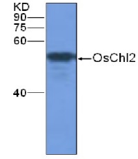 MatK | Maturase K in the group Antibodies for Plant/Algal / Photosynthesis / Biogenesis/architecture at Agrisera AB (Antibodies for research) (AS13 2720)